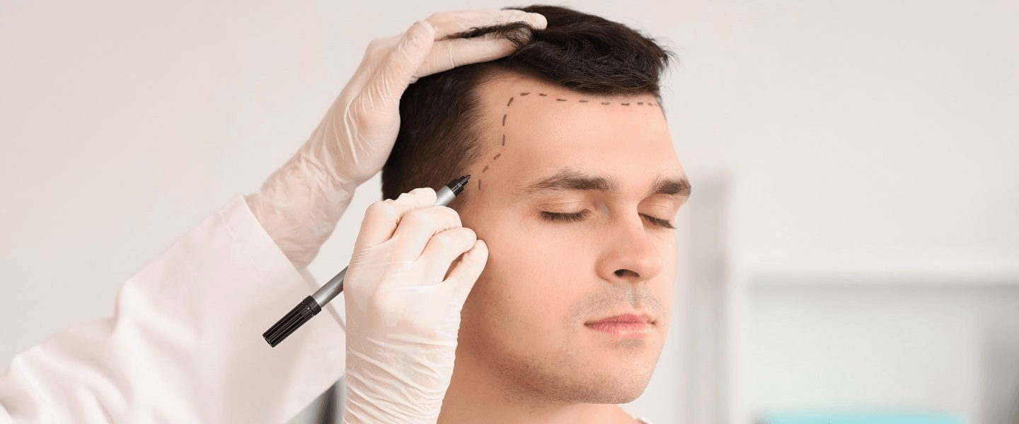 Hair Transplant Surgery / Hair Restoration