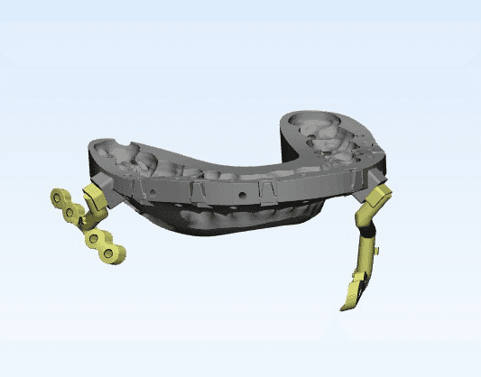 3D Printed Surgical Innovation
