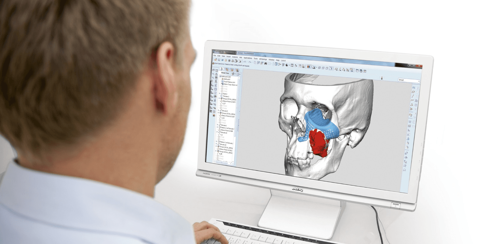 3D Virtual Surgical Planning